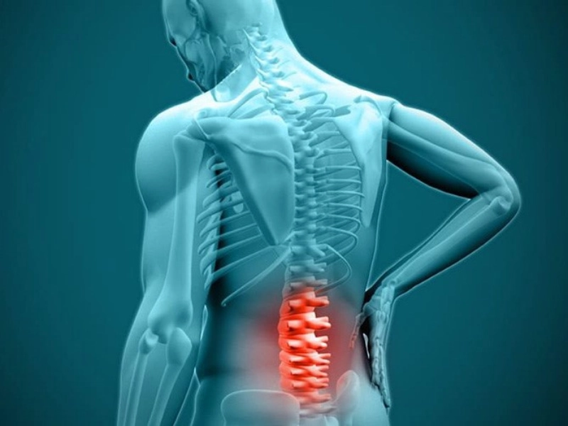 چه زمانی دیسک کمر خطرناک است؟
